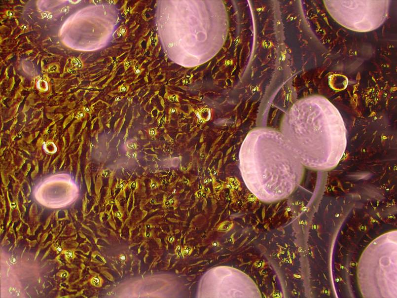 Fibroblasts